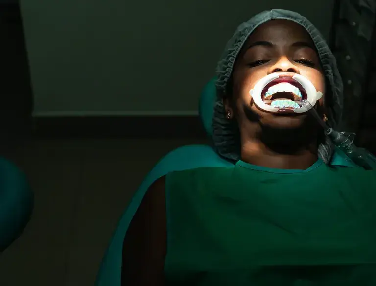 Teeth whitening in Bulawayo